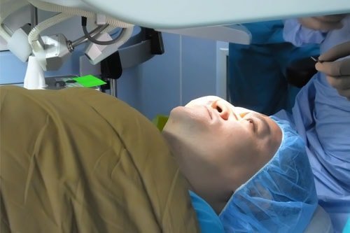 hedi-yunus-lasik-surgery-min