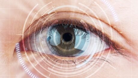 perbandingan metode lasik