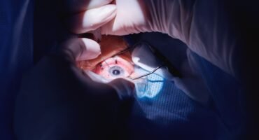 shutterstock_2405825613 (1) Mengenal Persamaan Lasik Mata dan Operasi Katarak