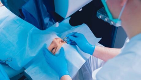 Perbedaan Lasik Mata dan Operasi Katarak